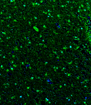 Goat anti-S100B Antibody