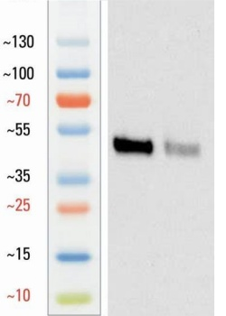 Goat anti-Vimentin Antibody