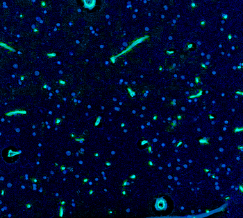 Goat anti-Nestin Antibody