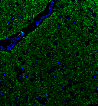 Goat anti-α-Synuclein Antibody