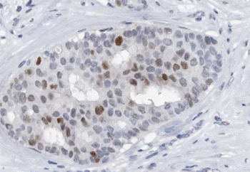 L-Lactyl-Histone H4 (Lys5)/H4K5la Antibody