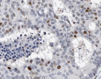 L-Lactyl-Histone H4 (Lys16) /H4K16la Antibody