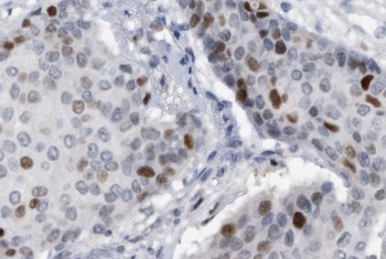 L-Lactyl-Histone H3 (Lys9)/H3K9la Antibody