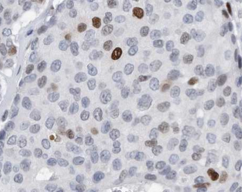 L-Lactyl-Histone H2A.Z (Lys11)/H2A.ZK11la Antibody