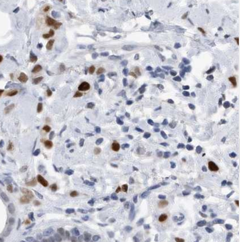 L-Lactyl-Histone H3 (Lys14)/H3K4la Antibody