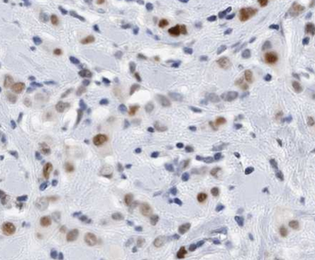 L-Lactyl-Histone H3 (Lys18)/H3K18la Antibody