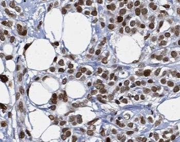 L-Lactyl-Histone H2B (Lys15)/H2BK15la Antibody