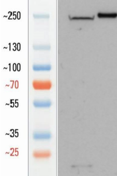 Goat Aggrecan Antibody