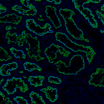 Goat Aggrecan Antibody