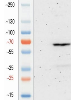 tdTomato Antibody