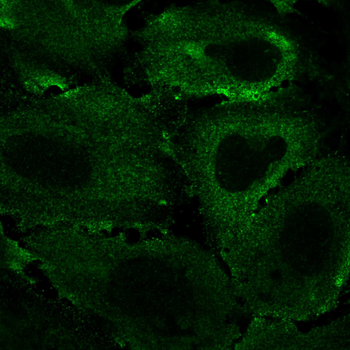 tdTomato Antibody