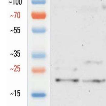 Goat a-Synuclein Antibody