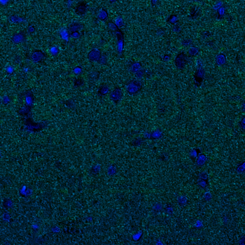 Goat a-Synuclein Antibody