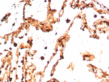 S100A4 / Metastasin / Calvasculin (Marker of Tumor Metastasis) Antibody