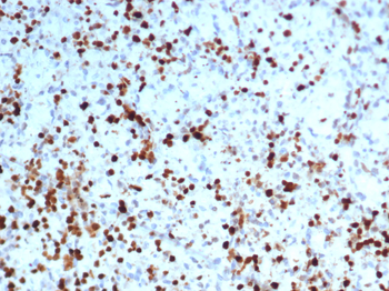 S100A4 / Metastasin / Calvasculin (Marker of Tumor Metastasis) Antibody