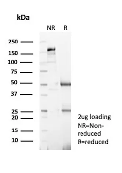 S100A4 / Metastasin / Calvasculin (Marker of Tumor Metastasis) Antibody