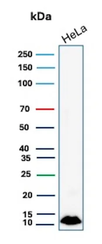 S100A4 / Metastasin / Calvasculin (Marker of Tumor Metastasis) Antibody