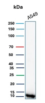S100A4 / Metastasin / Calvasculin (Marker of Tumor Metastasis) Antibody