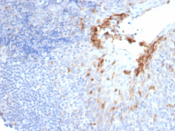 Recombinant CD10 (Membrane Metalloendopeptidase) Antibody