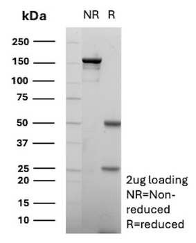 Recombinant CD10 (Membrane Metalloendopeptidase) Antibody