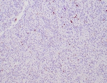 MGMT (Marker of Suppressor of Mutation and Carcinogenesis) Antibody