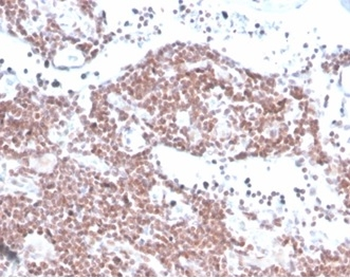 MGMT (Marker of Suppressor of Mutation and Carcinogenesis) Antibody