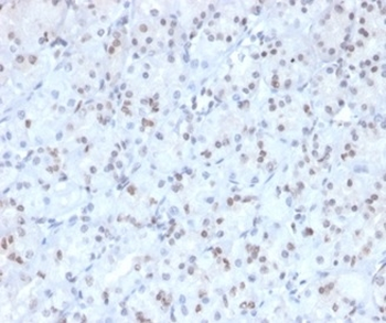 MGMT (Marker of Suppressor of Mutation and Carcinogenesis) Antibody