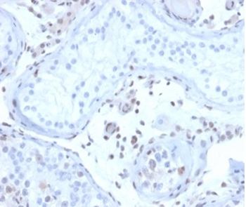 MGMT (Marker of Suppressor of Mutation and Carcinogenesis) Antibody