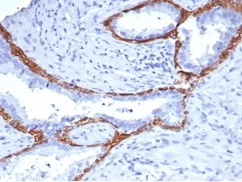 Cytokeratin 14 (KRT14) (Squamous Cell Marker) Antibody