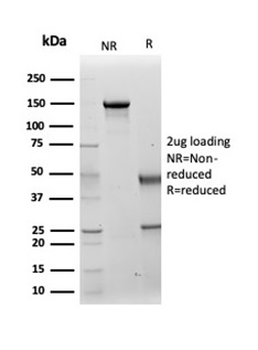 Cytokeratin 14 (KRT14) (Squamous Cell Marker) Antibody