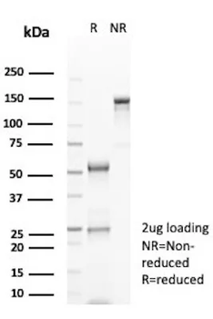 GFAP (Astrocyte & Neural Stem Cell Marker) Antibody