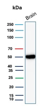 GFAP (Astrocyte & Neural Stem Cell Marker) Antibody
