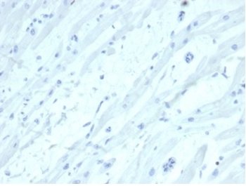 SATB2 (Colorectal Carcinoma Marker) Antibody