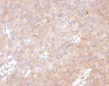 IL-6 (Interleukin-6) / Interferon beta-2 (Hybridoma Growth Factor) Antibody