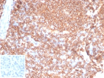 Recombinant CD45RA / LCA (B-Cell Marker) Antibody