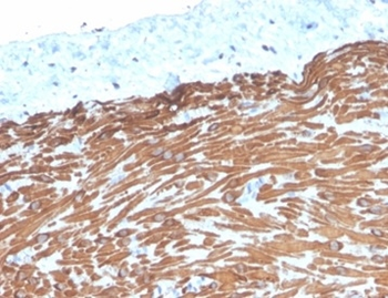 DES Antibody
