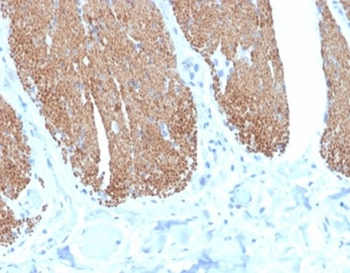 DES Antibody