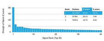 Recombinant Prostein (p501S) / Solute Carrier Family 45 Member 3 (SLC45A3) Antibody