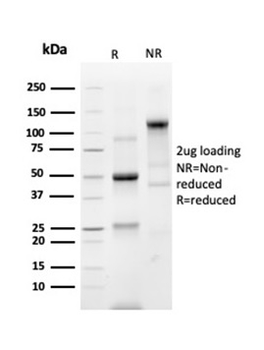 Recombinant Prostein (p501S) / Solute Carrier Family 45 Member 3 (SLC45A3) Antibody