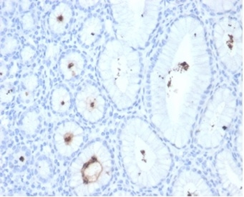 Helicobacter pylori (Catalase) Antibody