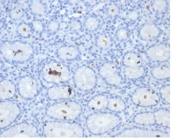 Helicobacter pylori (Catalase) Antibody