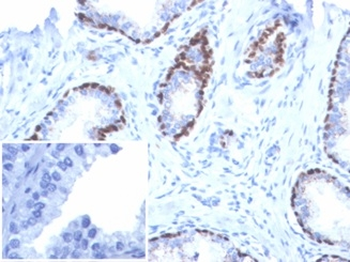 Recombinant p40 (Squamous, Basal & Myoepithelial Cell Marker) Antibody