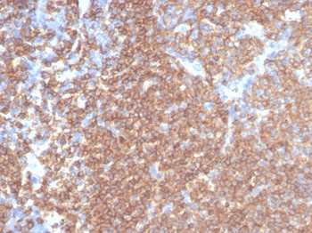 Recombinant CD45RA / LCA (B-Cell Marker) Antibody