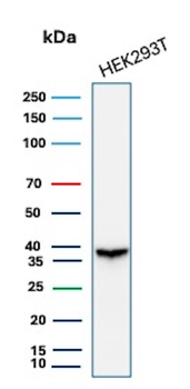 Recombinant Aldo-keto Reductase Family 1 Member B1 (Adrenal Marker) Antibody