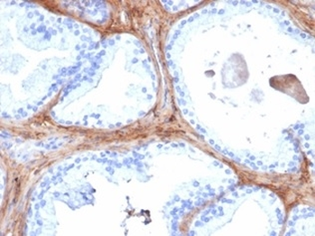 DCN Antibody