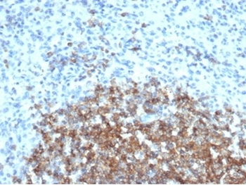 CD35 / CR1 (Follicular Dendritic Cell Marker) Antibody