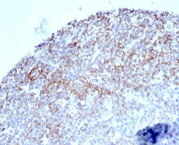 CD35 / CR1 (Follicular Dendritic Cell Marker) Antibody