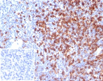 CD4 Antibody