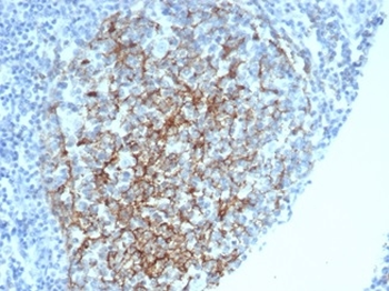CD35 / CR1 (Follicular Dendritic Cell Marker) Antibody