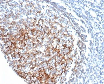 CD35 / CR1 (Follicular Dendritic Cell Marker) Antibody